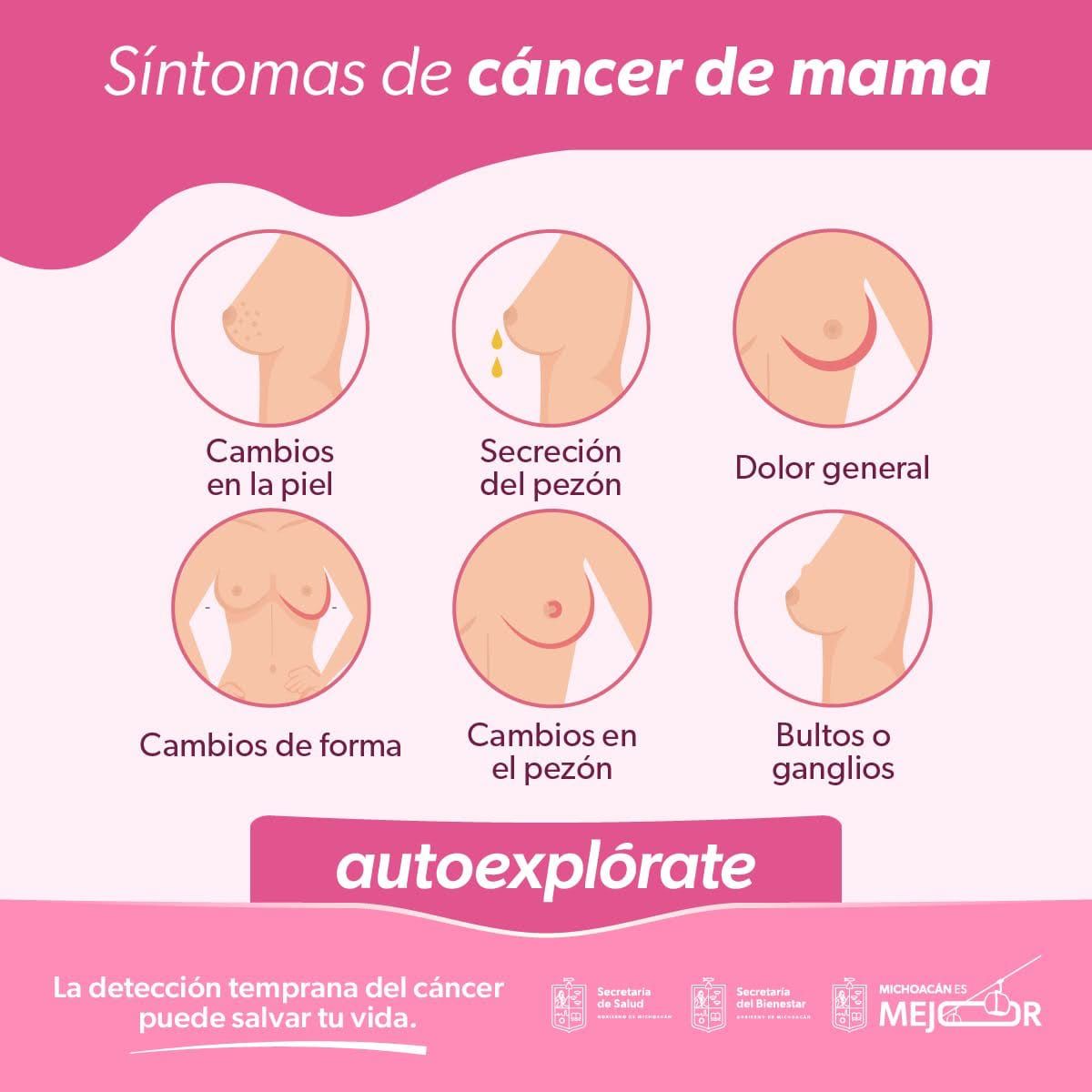 Reconoce los síntomas del cáncer de mama para actuar de inmediato