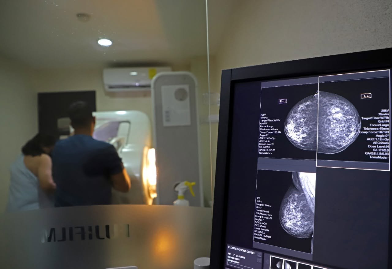 SSM ofrece mastografías gratuitas todo el año, en centro especializado para detección de cáncer